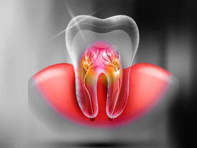 Eine digitale Darstellung von Nerven in einem Zahn