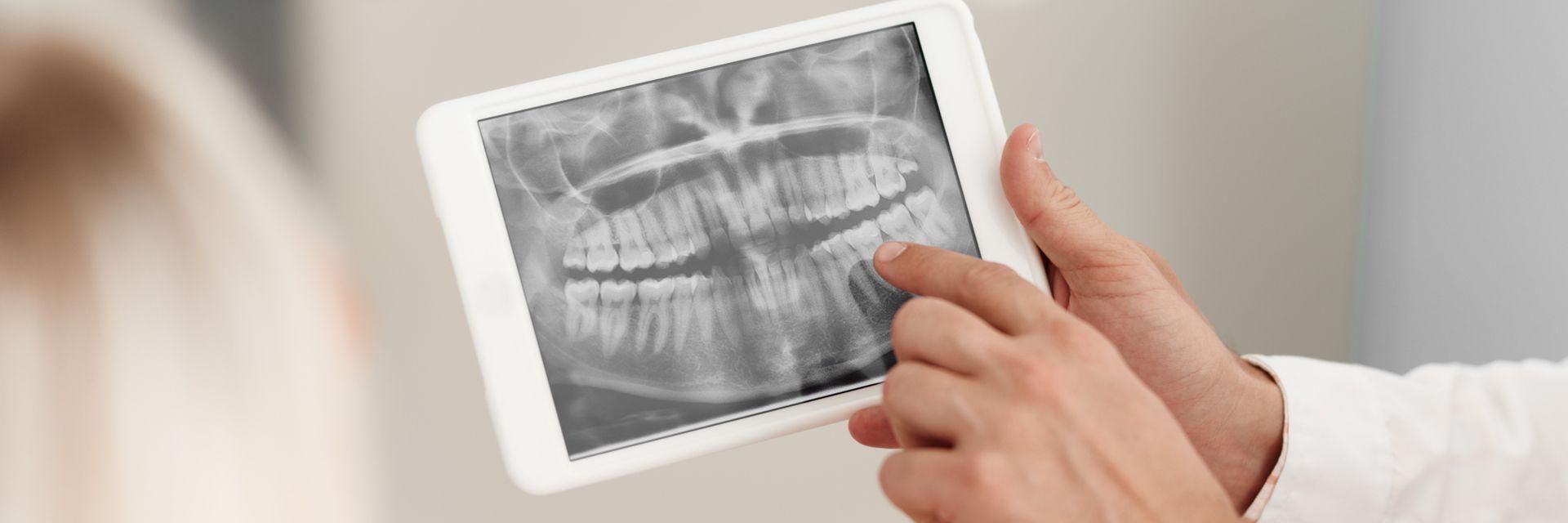 Photo of an X-ray image on an iPad held by a dentist