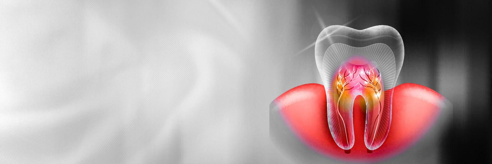 A digital representation of nerves in a tooth