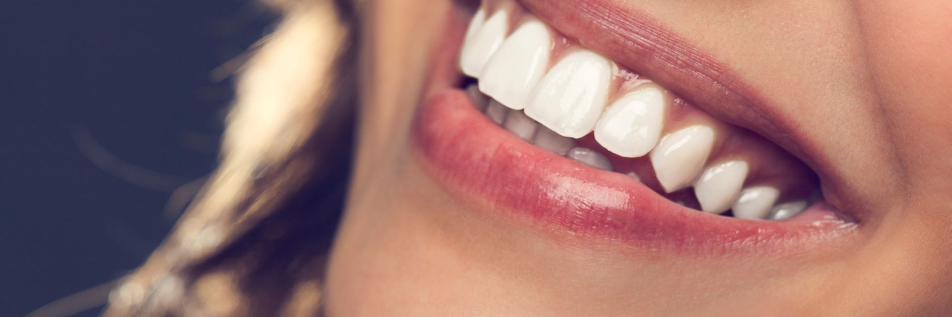 Gumlift - Ein minimalinvasives, schmerzarmes Verfahren bei Zahnfleischschwund.