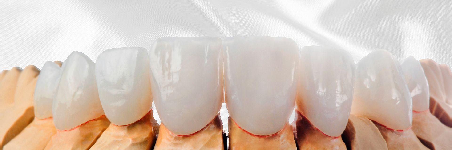 Depiction of ceramic teeth
