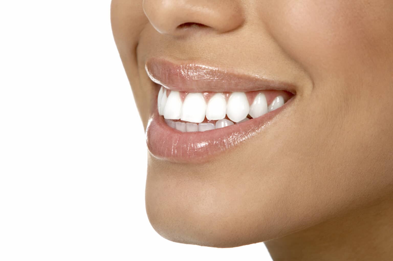 Ästhetisch-plastische Parodontalchirurgie – smileDentity Dreieich