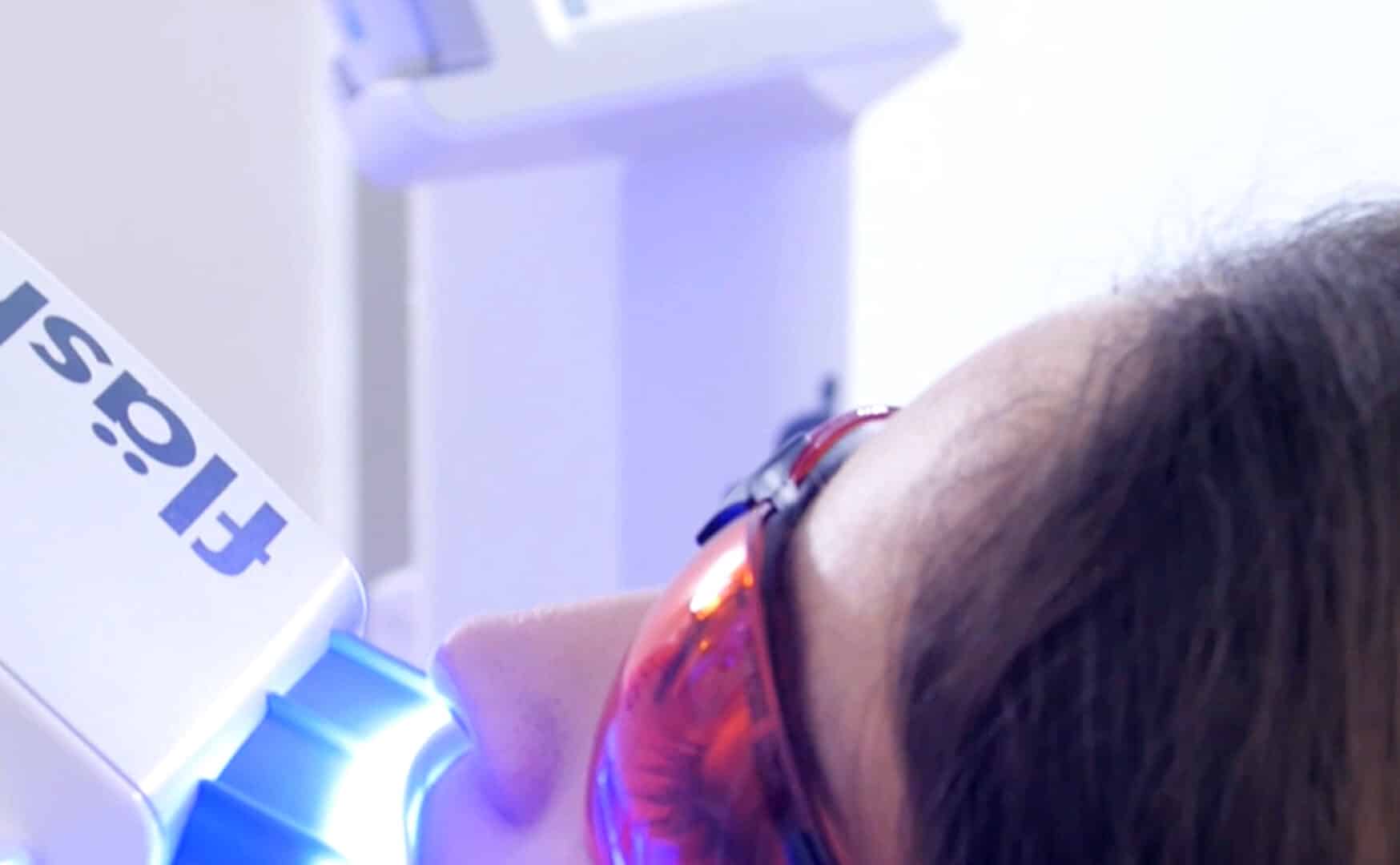 In-Office Bleaching mit fläsh. — Fortsetzung