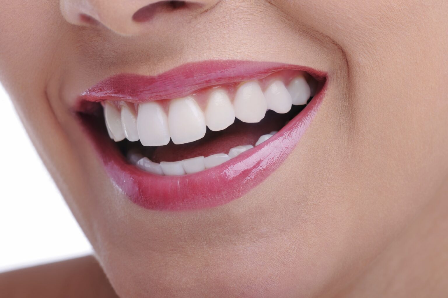 Ästhetische Frontzahnfüllungen – smileDentity Dreieich